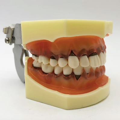 #ad Dental Model Periodontics Calculus Demonstration Teaching Dentists Communication $45.00