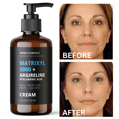 #ad Matrixyl 3000 Argireline Hyaluronic Acid Peptide AntiAging serum Wrinkle CREAM $17.99