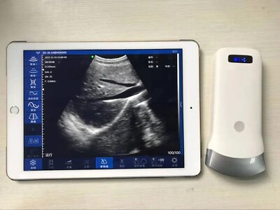 #ad Digital Portable Ultrasound Equipment Linear Probe ios Andriod US local Shipping $902.50
