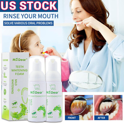 #ad 2pcs Teeth Whitening Foam Toothpaste Stain Removal Teeth Deep Cleansing Mousse $8.95