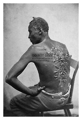 #ad AFRICAN AMERICAN SLAVE ENSLAVED MANS SCARRED BACK 1863 4X6 PHOTO $7.97