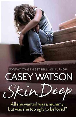 #ad Skin Deep: All She Wanted Was a Mummy but Was She Too Ugly to be Loved? by Case $15.06