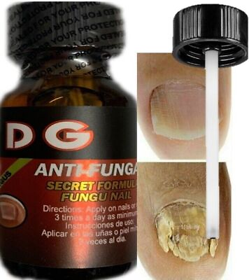 #ad Natural Nails Infection Anti fungal Athlete’s Foot Skin Fupport Organic $34.62
