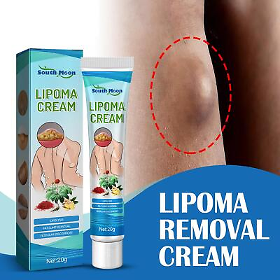 Lipoma Removal Cream Treat Tumor Skin Swelling Ointment Relief 20g $3.04