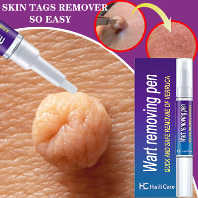 #ad 12Hours Wipe Off Moles Remover Natural Liquid Skin Tagsamp;Moles Warts Corn Remover $8.56